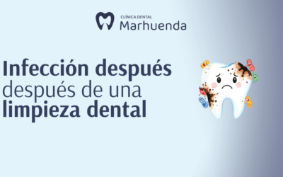 Infección después de una limpieza dental​