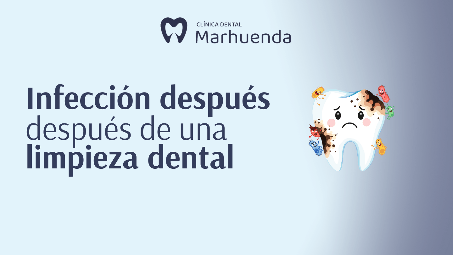 infeccion después de una limpieza dental​