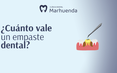 Cuánto vale un empaste dental
