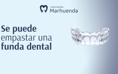 Se puede empastar una funda dental