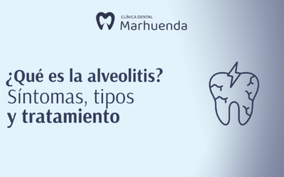 ¿Qué es la alveolitis? Síntomas, tipos y tratamiento