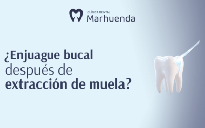 ¿Enjuague bucal después de extracción de muela?