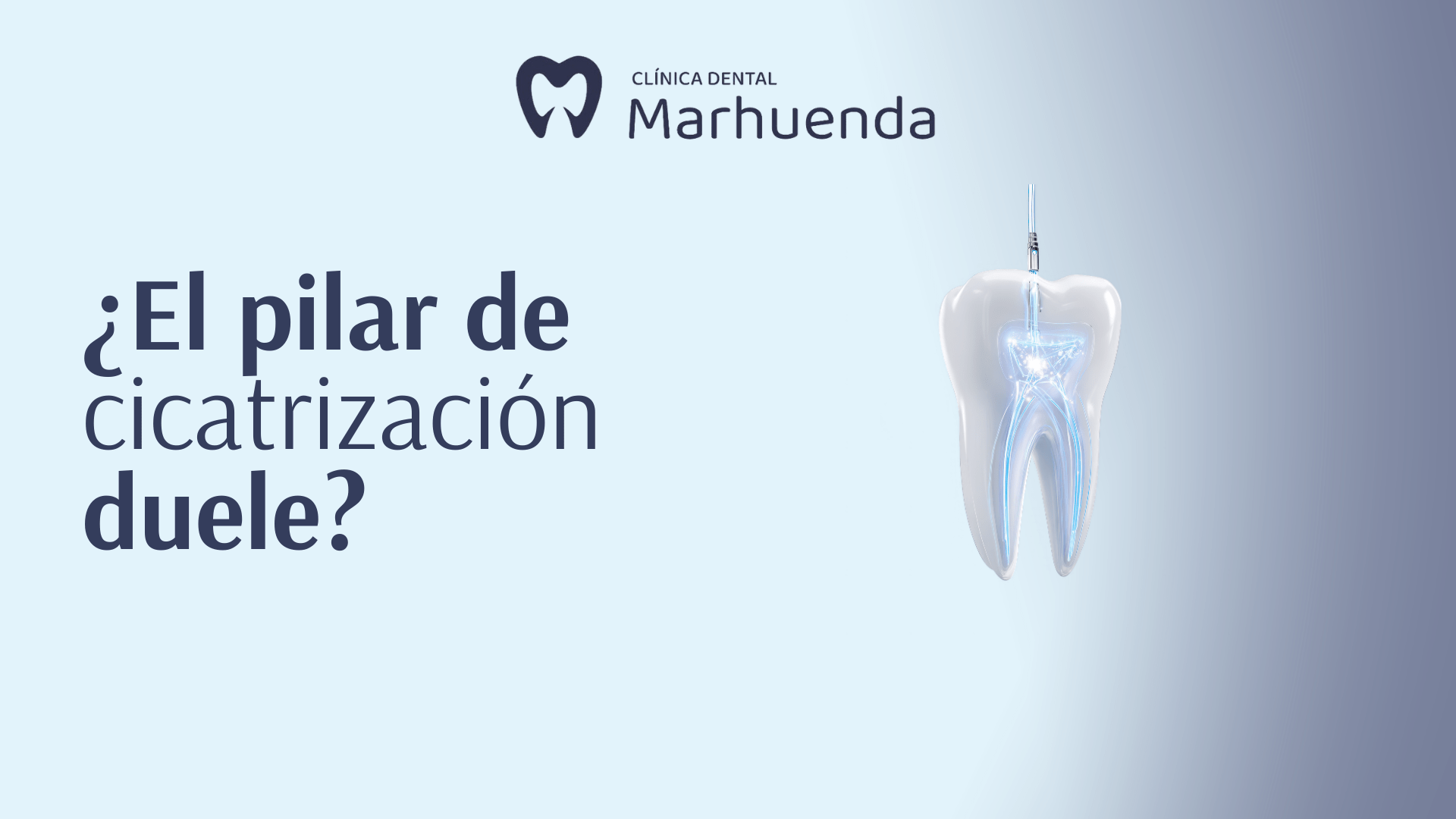 ¿El pilar de cicatrización duele? ¿El pilar de cicatrización duele?