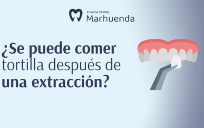 ¿Se puede comer tortilla después de una extracción de muela?