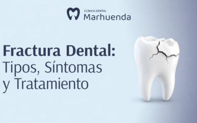Fractura Dental: Tipos, Síntomas y Tratamiento