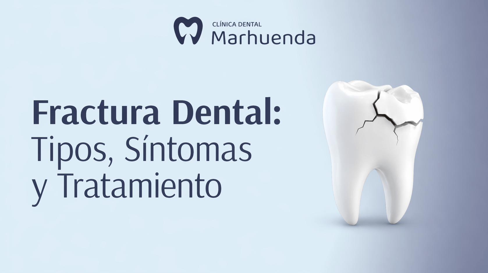 Fractura Dental: Tipos, Síntomas y Tratamiento