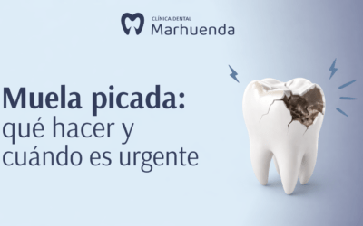 Muela picada: qué hacer y cuándo es urgente