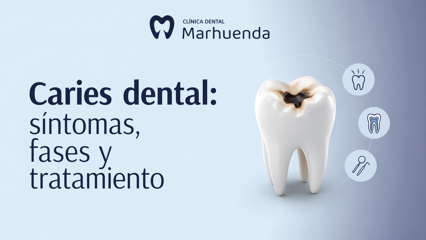Cavidades dentales: síntomas y tratamiento
