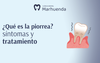 Piorrea: qué es, síntomas y tratamiento