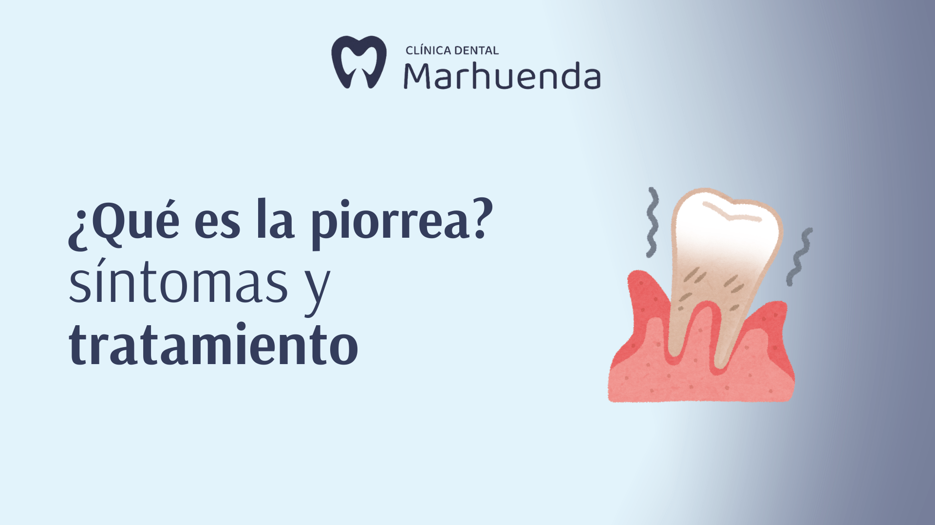 Piorrea: qué es, síntomas y tratamiento