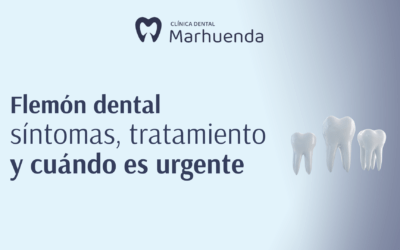 Flemón dental: síntomas, tratamiento y cuándo es urgente