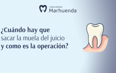¿Cuando hay que sacar la muela del juicio y como es la operación?