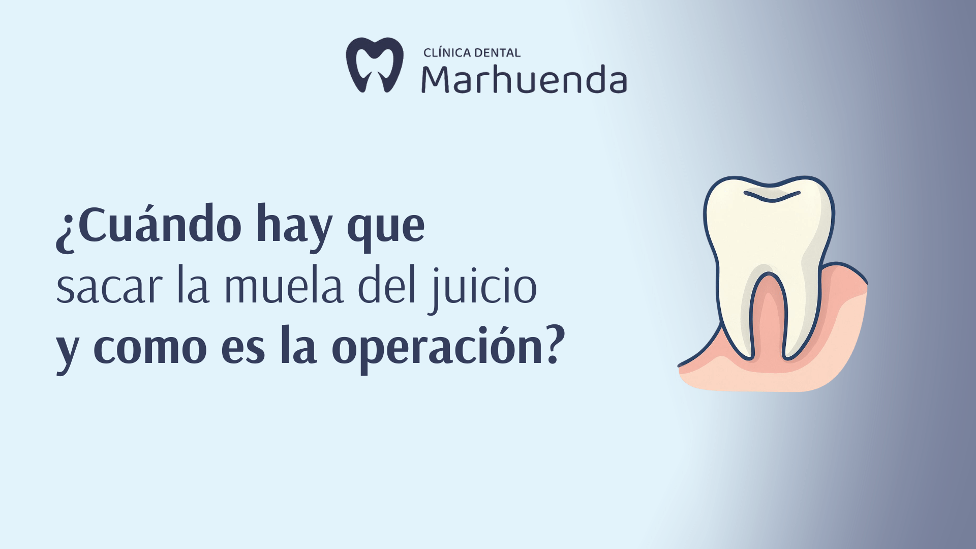 ¿Cuándo hay que sacar la muela del juicio y como es la operación?