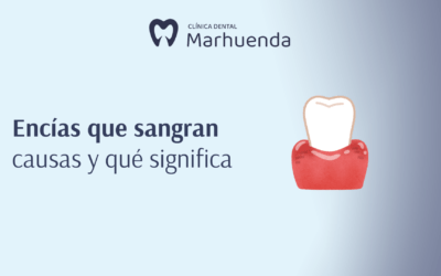 Encías que sangran: causas y qué significa