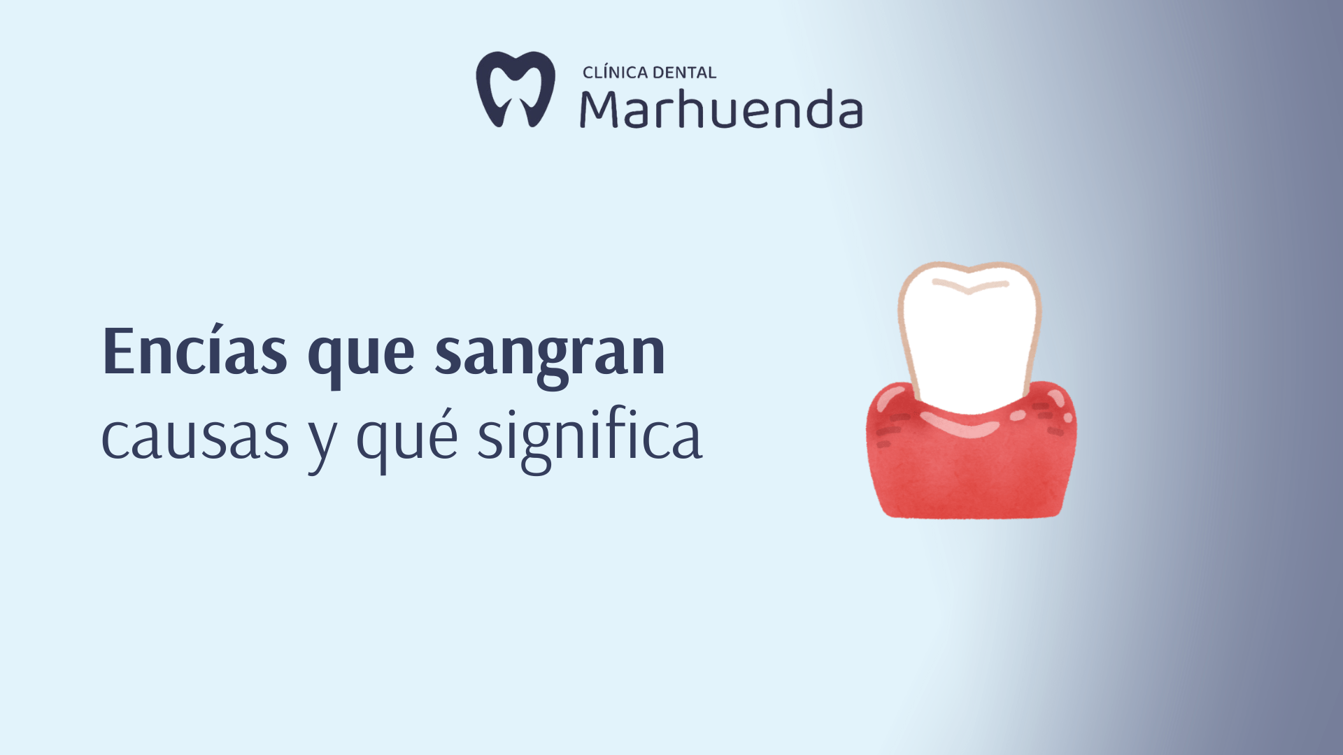 Encías que sangran: causas, qué significa