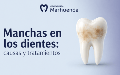 Manchas en los dientes: causas y tratamientos
