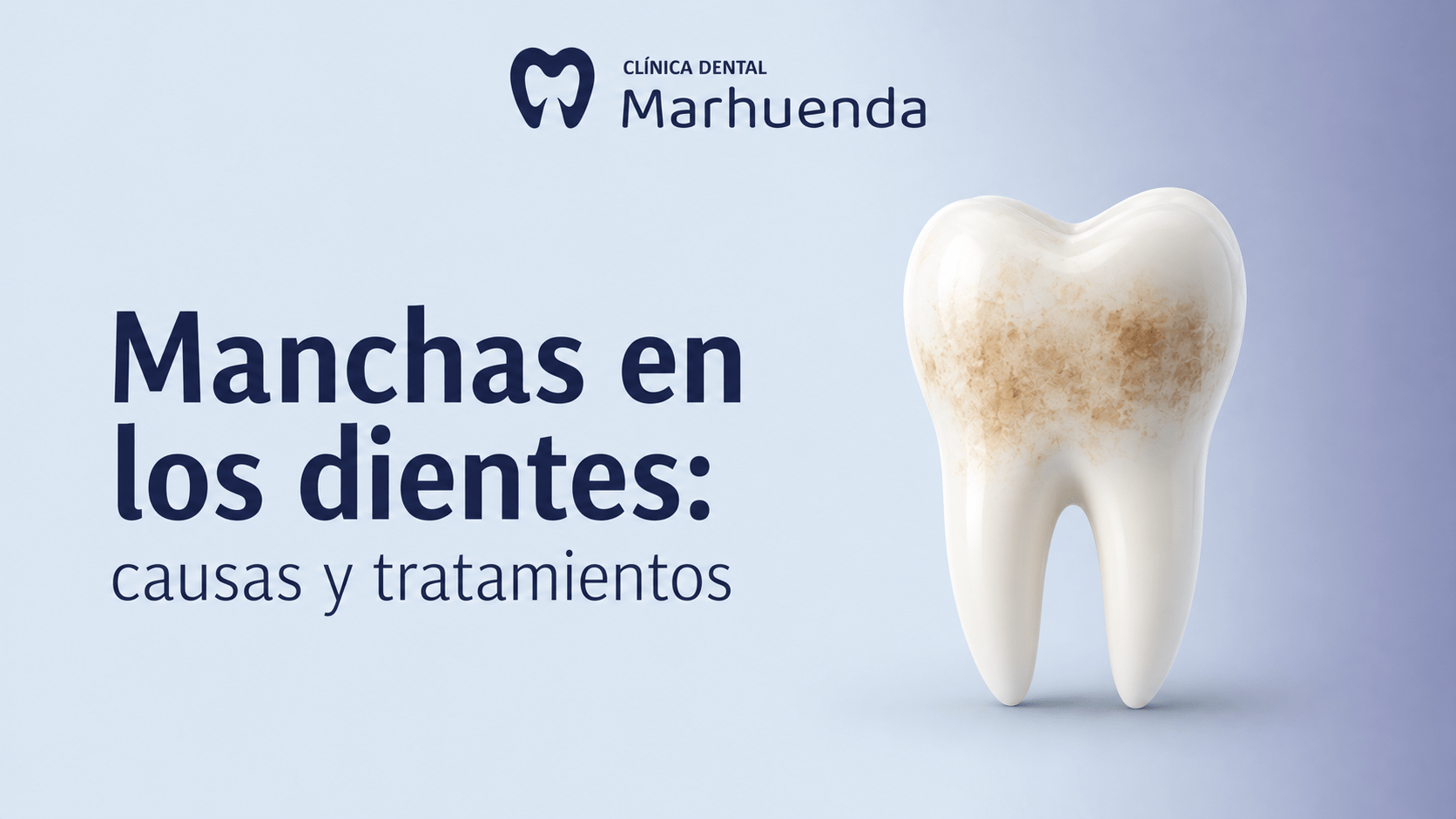Manchas en los dientes: causas y tratamientos Manchas en los dientes: causas y tratamientos
