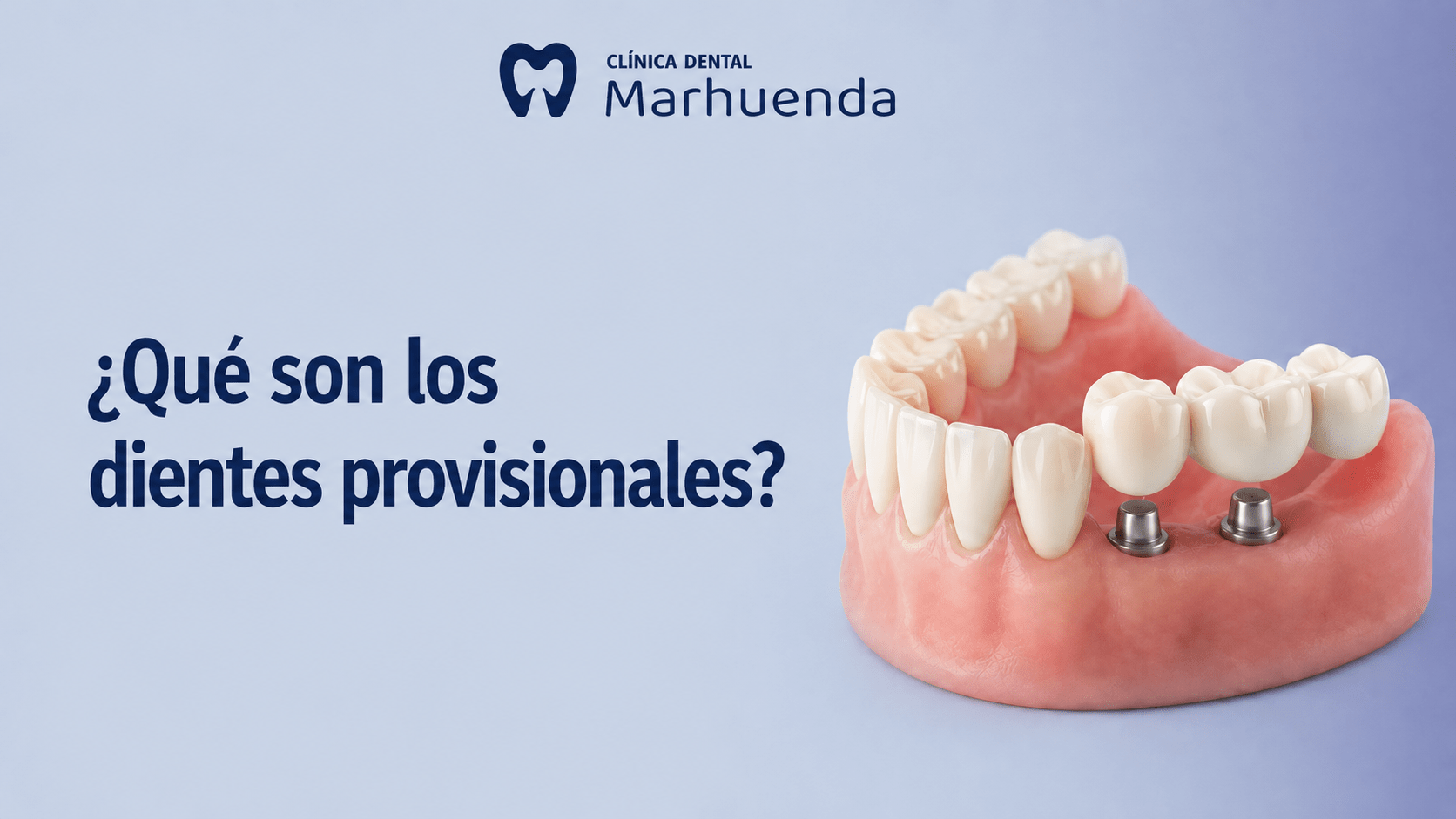 Dientes provisionales: Dientes provisionales
