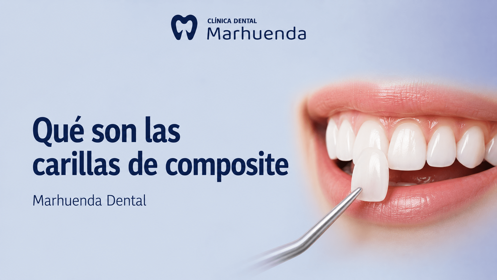 Qué son las carillas de composite