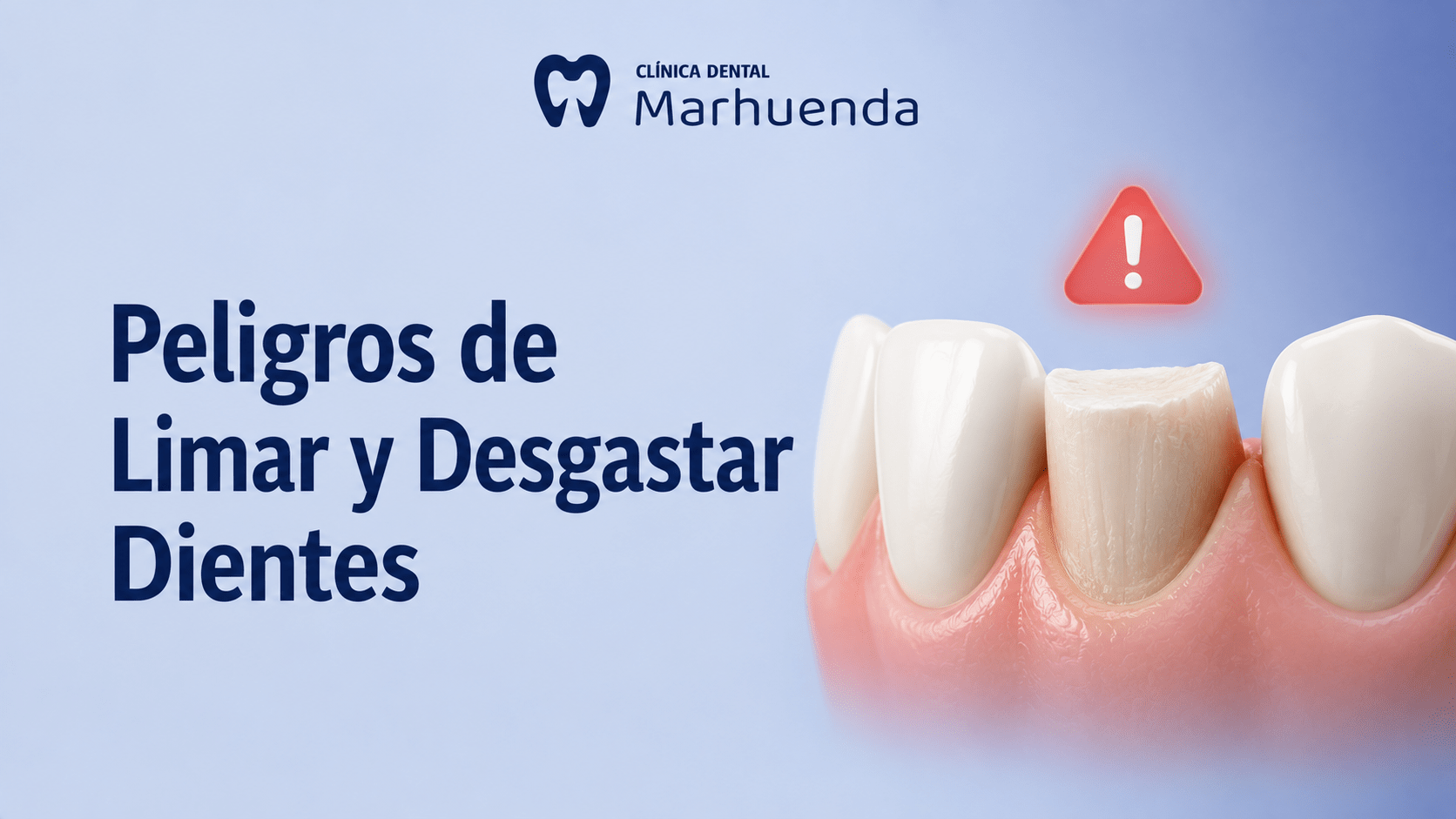 Peligros de Limar y Desgastar Dientes