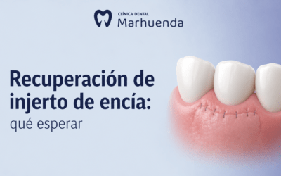 Recuperación de injerto de encía: qué esperar