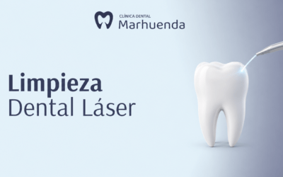Limpieza Dental Láser: Qué es y por qué la necesitas