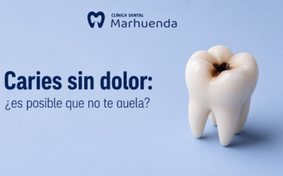 Caries sin dolor: ¿es posible que no te duela?
