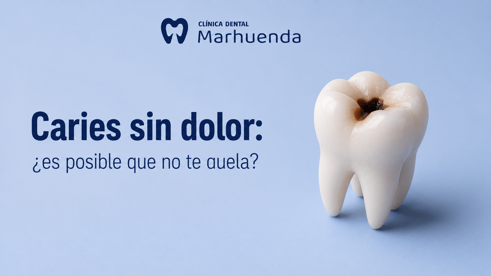 Caries sin dolor: ¿es posible que no te duela? Caries sin dolor: ¿es posible que no te duela?