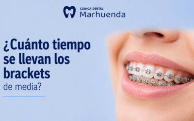 ¿Cuánto tiempo se llevan los brackets de media?