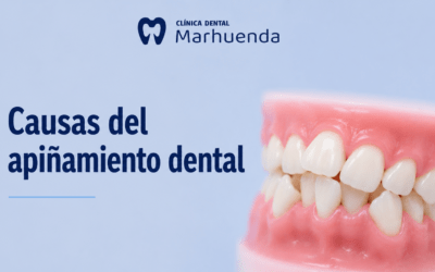 Causas del apiñamiento dental: por qué se tuercen los dientes